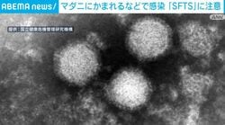 マダニにかまれるなどで感染 「SFTS」に注意