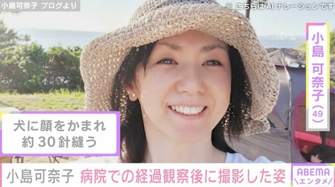 【写真・画像】犬に顔をかまれ約30針縫った小島可奈子（49）、病院での経過観察後に撮影した自身の姿を公開　1枚目