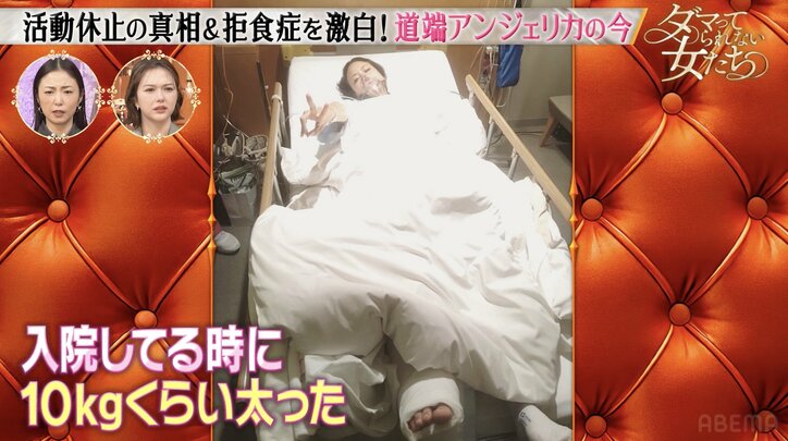 【写真・画像】拒食症だった人気モデル、救急搬送された過去「転んだだけで足首が反対側向いた」　2枚目