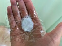 薬丸裕英『今回ダメなら手術』