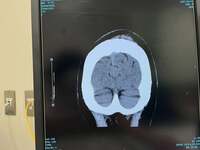 遠山ちづ子『転んで飛んで頭を打って❗️』