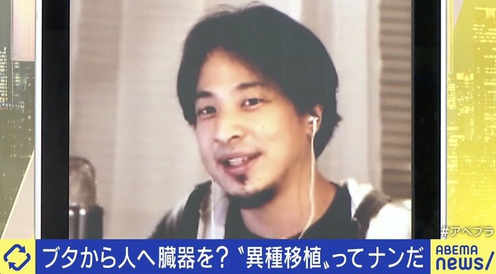 ひろゆき専用臓器も可能に? 10年後には実現か ブタ→人間の異種移植