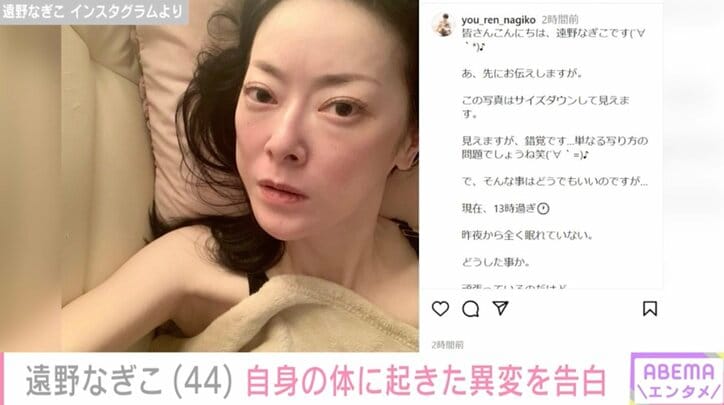 【写真・画像】摂食障害公表の遠野なぎこ「昨夜から全く眠れていない」最近の悩みや病のリアルを赤裸々に告白し「とても心配です」の声　1枚目