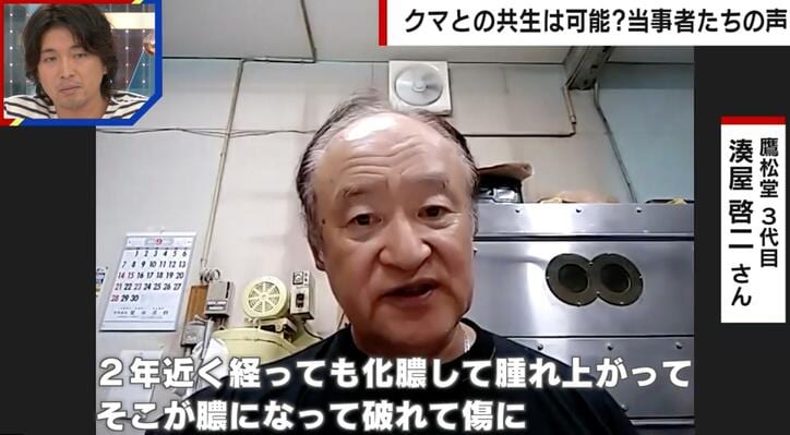 【写真・画像】クマに襲われ30針以上を縫うケガ…後遺症に苦しむ被害者「2年経っても化膿」「涙がすごく出る」　1枚目