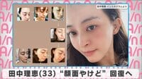 田中理恵”顔面やけど”回復へ