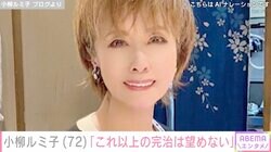 小柳ルミ子「これ以上の完治は望めない」1年前に転倒し骨折した右手の現状を報告