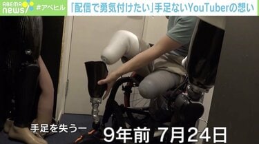 何度も死のうと思った」飲み会帰り、電車に轢かれて…20歳で手足3本を切断したYouTuberが“孤独”から這い上がるまで | 国内 | ABEMA  TIMES | アベマタイムズ