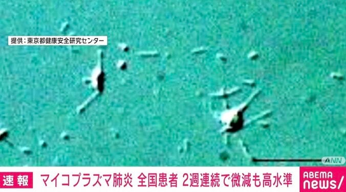 【写真・画像】マイコプラズマ肺炎の患者数 2週連続でわずかに減少も依然高い水準　1枚目