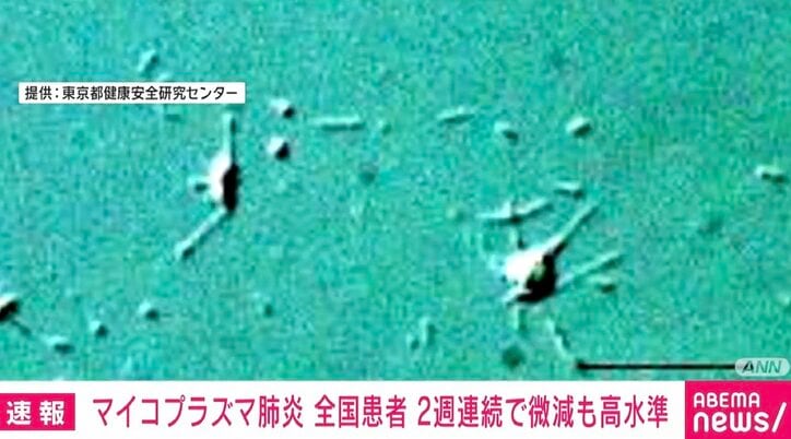 【写真・画像】マイコプラズマ肺炎の患者数 2週連続でわずかに減少も依然高い水準　1枚目