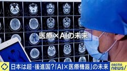 ヒトの命を救う「AI医療機器」開発できても…導入できない？背景に“診療報酬制度の壁”