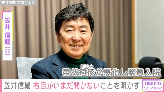 【写真・画像】緊急入院した元フジアナ・笠井信輔（62）「片目だって働けますから」右目がいまだ開かないことを明かす　1枚目