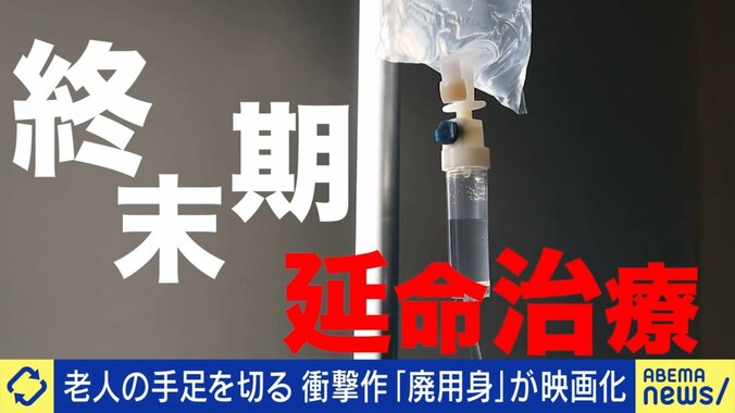 終末期の延命治療