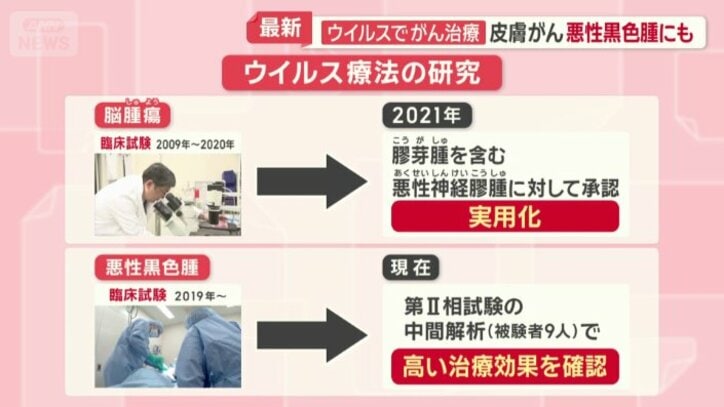 ウイルス療法の研究
