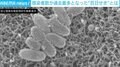 “百日せき”の感染者数が過去最多 専門家「大人は死ぬことはないが、子どもにうつすと大変」「2カ月までの赤ちゃんはけっこう危険」
