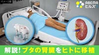 【映像】“ブタの腎臓をヒトに移植”脳死状態で