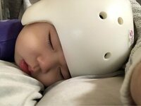 大渕愛子『ヘルメット治療卒業の日』