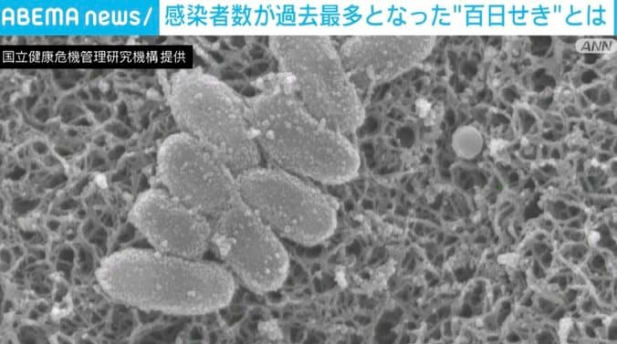 【写真・画像】“百日せき”の感染者数が過去最多 専門家「大人は死ぬことはないが、子どもにうつすと大変」「2カ月までの赤ちゃんはけっこう危険」　1枚目