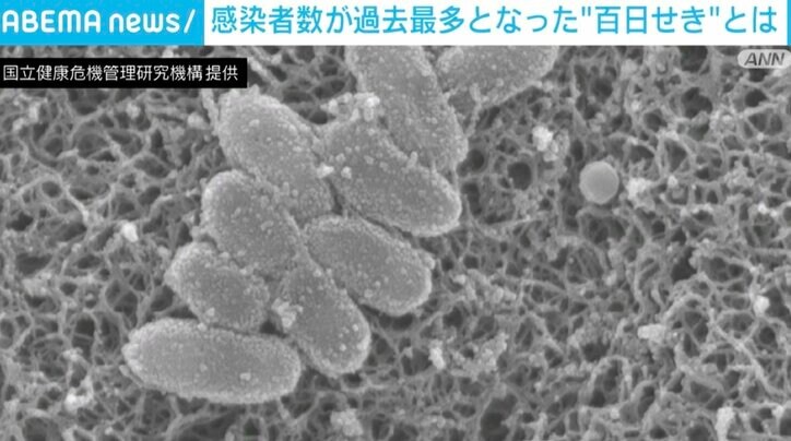 【写真・画像】“百日せき”の感染者数が過去最多 専門家「大人は死ぬことはないが、子どもにうつすと大変」「2カ月までの赤ちゃんはけっこう危険」　1枚目