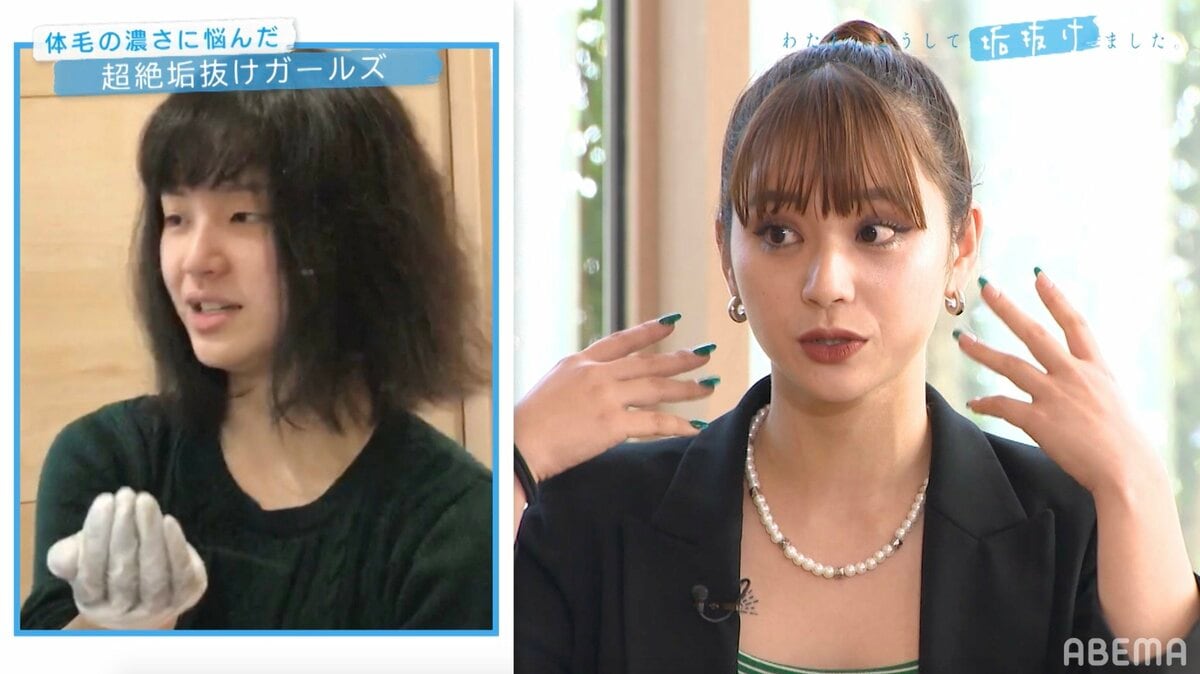 もみあげ 垢抜け