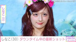 両顎の骨切り手術を受けた・しなこ（30）、ダウンタイム中に母親からプレゼント 「愛がとても伝わってくる」などの声