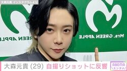 激変した姿が話題・ミセス 大森元貴「にきびできた」自撮りショットに反響