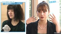 あだ名は「もみあげジョリーヌ」…コンプレックスを抱えた女子の垢抜けビフォーアフター