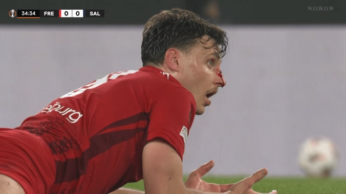 鼻から大量流血…「肘を振ってる」超危険エルボーで一発退場「なんで笑ってる？」「今大会終了だな」22歳FWに批判殺到 3枚目