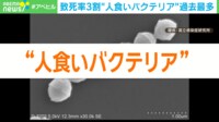 足のわずかな傷→手術で右足切断の事態に！ 致死率3割"人食いバクテリア"過去最多 専門家「靴ずれも非常に大きなリスク」