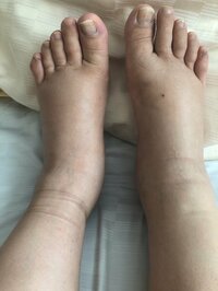 キンタロー。『浮腫対策の結果。パンはお好きですか？』