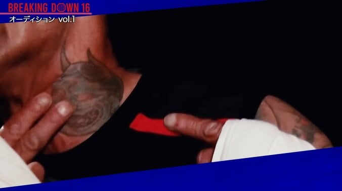 ドスで切りつけられたという首の傷跡