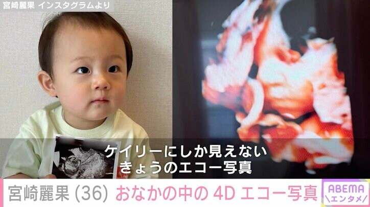 【写真・画像】第5子妊娠中・宮崎麗果、“第4子にそっくり”おなかの中の最新4Dエコー写真を公開 2枚目
