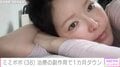34歳で余命宣告を受けたミミポポ（38）、新たに始めた治療の副作用で1カ月ダウン「動きたくても動けなくて…」