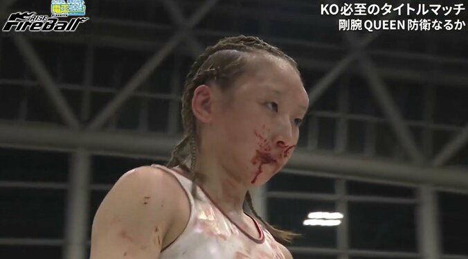 新女王の宮本芽依（KRAZY BEE）