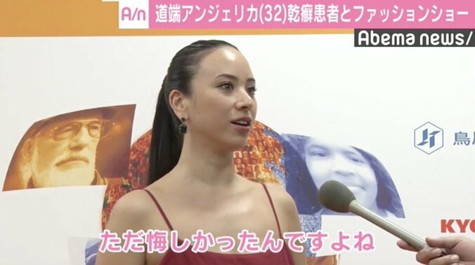 道端アンジェリカ、“乾癬”告白の理由は「ただ悔しかった」 1枚目