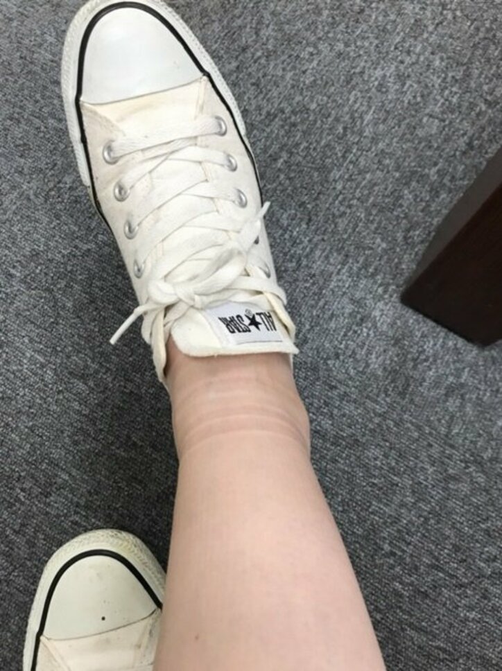 相沢まき、妊娠中のむくみが凄まじく不安「結婚指輪がこのまま入るか」「エグい」