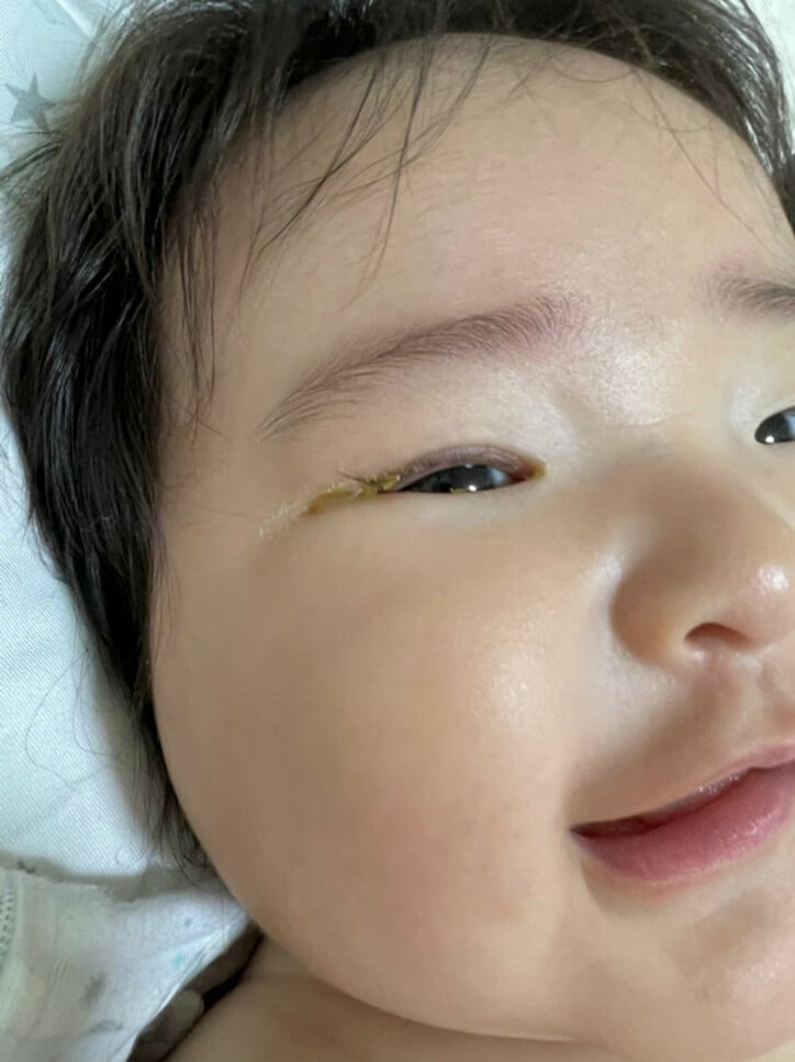  内山信二の妻、4カ月経つも治らない娘の目の症状を心配「手術できる半年までは後2カ月」 
