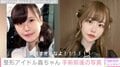 総額約1350万円の整形アイドル轟ちゃん、整形前後の写真公開で本音「クソ面長から普通の面長になれた」「このくらいが整形のリアル」