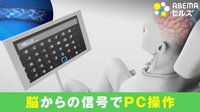 【映像】脳の“信号”でパソコン操作 アメリカで臨床試験へ