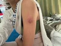 美優『痒いな〜』