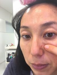 東尾理子 娘にひっかかれた顔を公開、ノーメイクの肌の綺麗さに反響