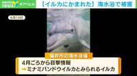 【映像】「イルカにかまれた」海水浴で被害