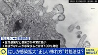 【映像】 はしか感染拡大 ワクチン接種確認方法は?