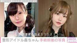 総額約1350万円の整形アイドル轟ちゃん、整形前後の写真公開で本音「クソ面長から普通の面長になれた」「このくらいが整形のリアル」