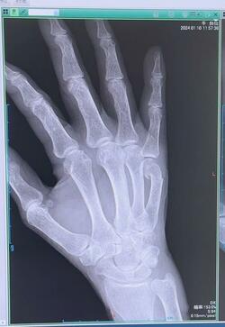  小柳ルミ子、レントゲン検査の結果を報告「手術を覚悟していました」 