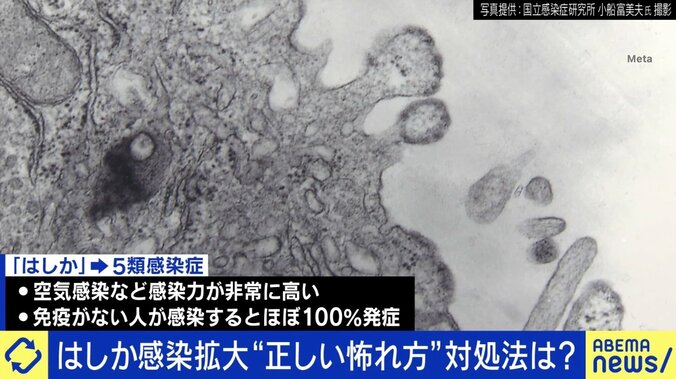 医師に聞く“はしか”の正しい怖がり方「ワクチン2回でまず防げる」接種有無を調べる方法は 1枚目