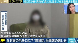 いけないと分かっていても…緊張や不安などを感じると爪や髪の毛を食べてしまう「異食症」の女性