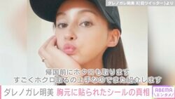 ダレノガレ明美「根性焼きではないのでご安心ください」胸元に貼られた複数のシールを説明
