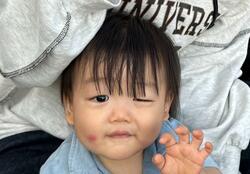  あいのり・桃、手術を決断した次男の眼瞼下垂の症状「目が開かないだけじゃない」 