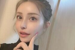35歳でおばあちゃんになった美女、総額1000万円超の美容整形を告白「鼻に200万円課金してます」