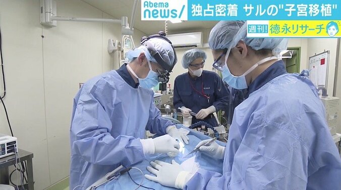 “子宮移植後”のサルで初の妊娠に成功、最新医療から見えた不妊治療の可能性と課題 1枚目